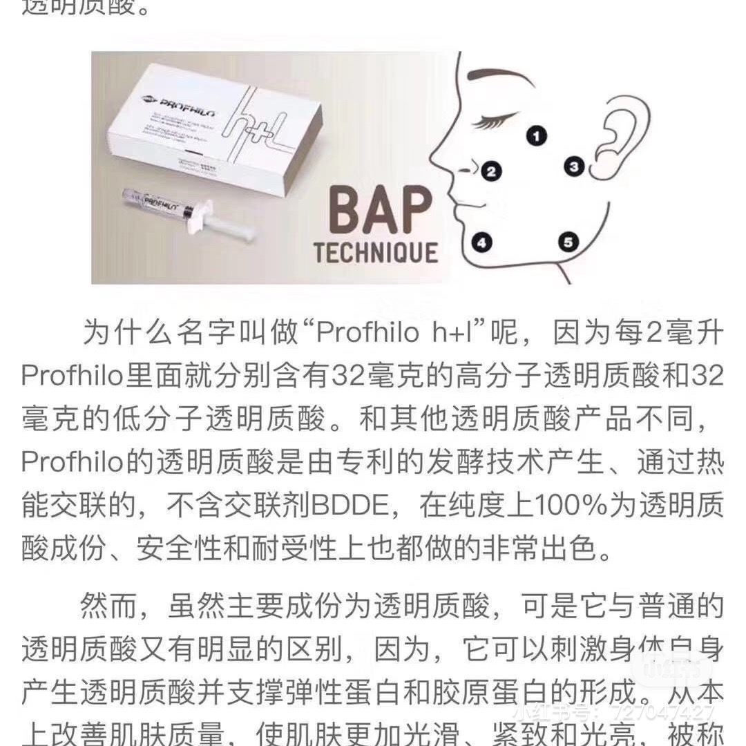 瑞士profhilo 逆龄提升针 profhilo h l 5点提升针注射点位图 怎么打